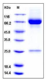 SDS-PAGE (MMP8-2529H).jpg
